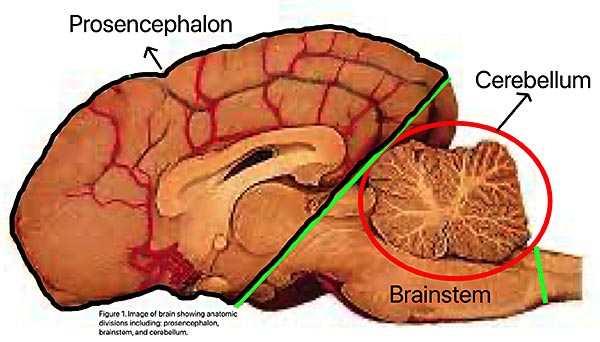 Illustration of Brain