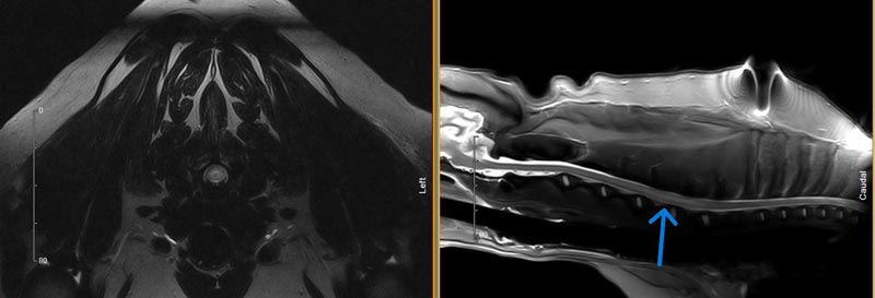 *Figure 4: MRI images of a fibrocartilageous embolism in a dog.